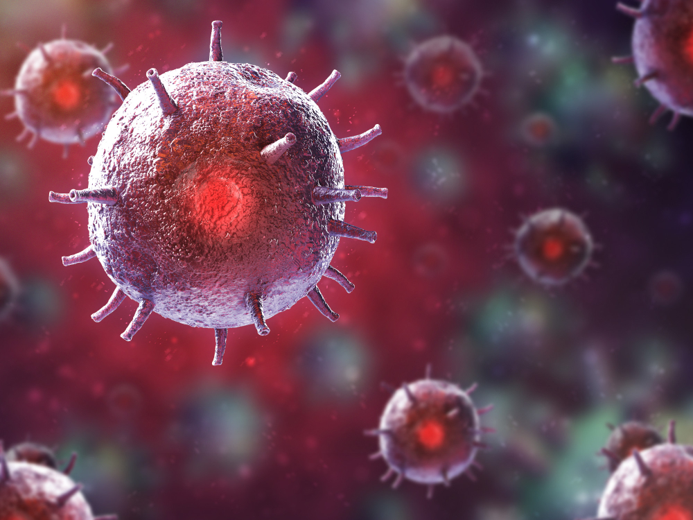 Tumore alla vescica sintomi cause diagnosi e trattamenti